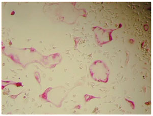 抗酒石酸酸性磷酸酶 TRAP 染色试剂盒 TRAP Staining Kit