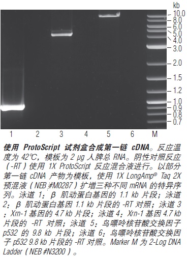 ProtoScript cDNA 第一链合成试剂盒 &nbsp;&nbsp;&nbsp;&nbsp;&nbsp;&nbsp;&nbsp;&nbsp;&nbsp;&nbsp;&nbsp;&nbsp;&nbsp;&nbsp;&nbsp;&nbsp;&nbsp;&nbsp;&nbsp;&nbsp; &nbsp;&nbsp;&nbsp;&nbsp;&nbsp;&nbsp;&nbsp;
