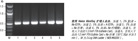 血源扩增 Hemo KlenTaq® &nbsp;&nbsp;&nbsp;&nbsp;&nbsp;&nbsp;&nbsp;&nbsp;&nbsp;&nbsp;&nbsp;&nbsp;&nbsp;&nbsp;&nbsp;&nbsp;&nbsp;&nbsp;&nbsp;&nbsp; &nbsp;&nbsp;&nbsp;&nbsp;&nbsp;&nbsp;&nbsp;