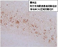 Tau 抗体系列                              阿尔茨海默病相关抗体