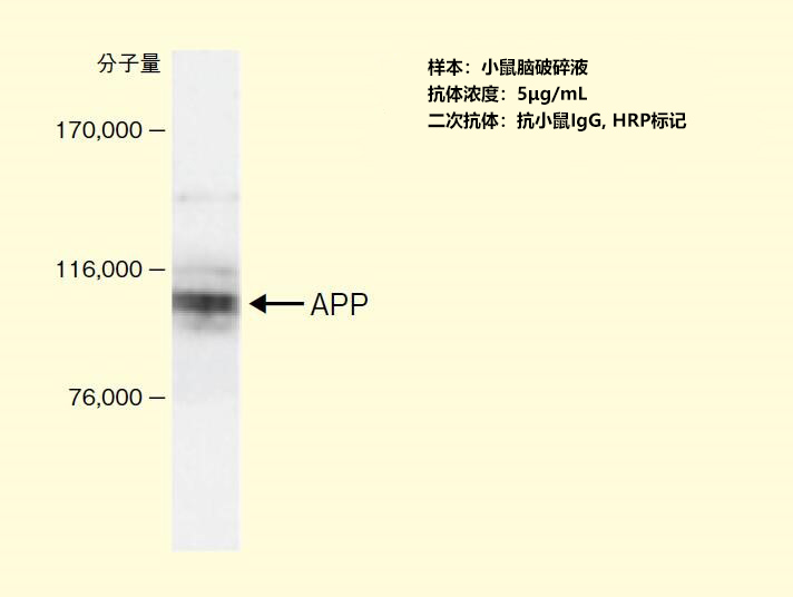 抗淀粉样蛋白前驱体蛋白                              神经退行性疾病研究用