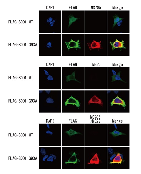 Anti-SOD1（ALS-related mutants）Cocktail，Human，Rat-Mono （MS785/MS27）                              全面检测ALS相关SOD1突变体的混合型抗体