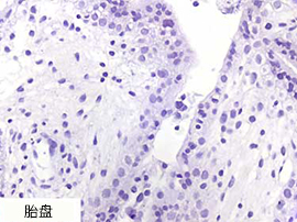 AMPIVIEW™ RNA 探针