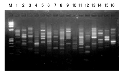 ISOPLANT II                              DNA快速提取试剂（植物/酵母/细菌）