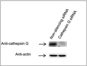 GenomONE® -Neo EX 仙台病毒包膜转染试剂 GenomONE® -Neo EX HVJ-E vials Transfection Reagents